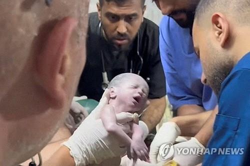 숨진 엄마 배 속에 있던 아기, 제왕절개로 생존
(로이터=연합뉴스) 팔레스타인 가자지구 라파에서 공습으로 숨진 엄마의 배 속에 있던 한 아기가 응급 제왕절개 수술을 통해 극적으로 생명을 건졌다. 사진은 배 속에서 막