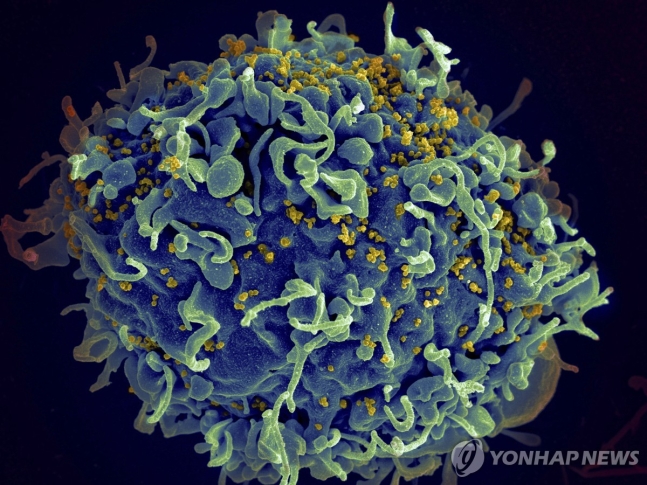 HIV에 공격받는 인간 T세포의 전자현미경 영상 [AP 연합뉴스 자료사진. 재판매 및 DB 금지]