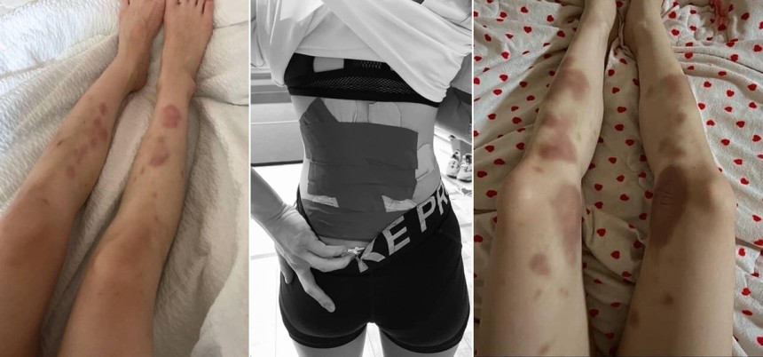 스턴트치어리더의 일상 (인천=연합뉴스) 화려한 치어리딩 기술은 하루아침에 완성되지 않는다.피멍이 가실 날이 없고 허리에 파스가 떨어질 날이 없을 정도로 강도 높은 연습이 수반되야 한다.2025.5.3 [문은비