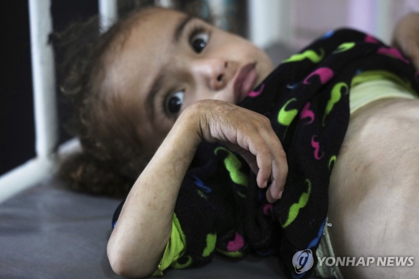 영양실조 겪는 가자지구 어린이
[AP 연합뉴스 자료사진. 재판매 및 DB 금지]