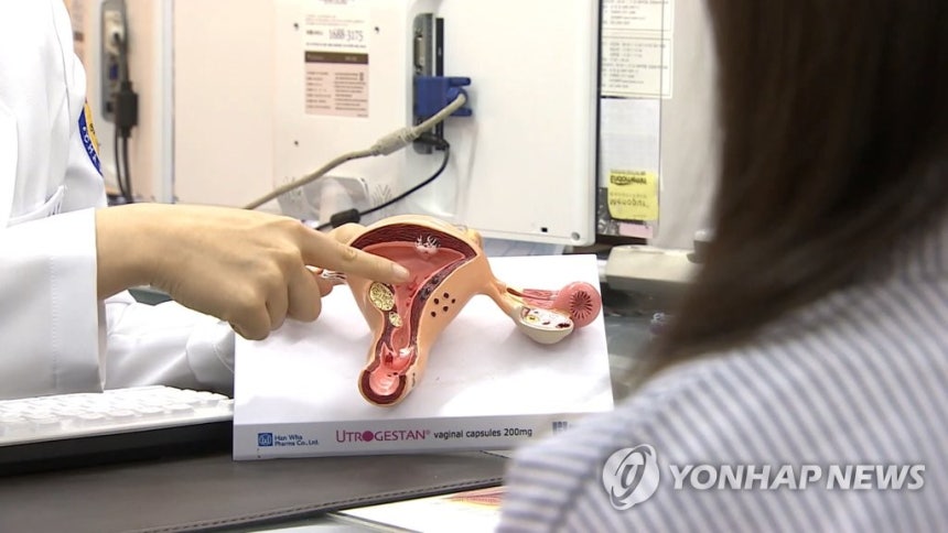 체외수정
[연합뉴스TV 제공]