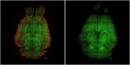 나노입자 투여 전과 후 생쥐 뇌 사진 비교 &lt;br/&gt;나노입자 약물을 투여하기 전(왼쪽)과 투여 12시간 후의 알츠하이머병 모델 생쥐 뇌를 촬영한 라이트 시트 형광 현미경(Light sheet fluorescence micro