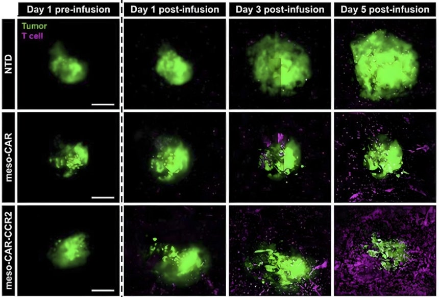 3차원 칩에서의 CAR-T 세포 치료 효과 관찰 
[가천대 신용희 조교수 제공. 재판매 및 DB 금지]