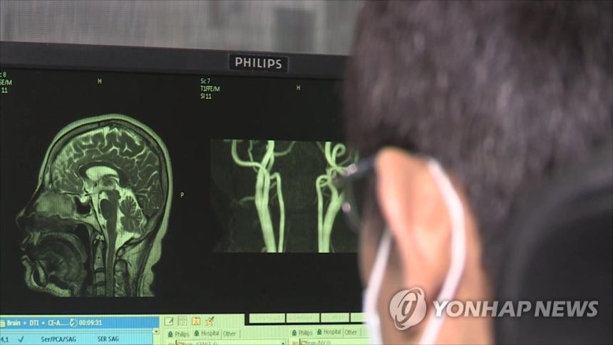 뇌질환 [연합뉴스TV 제공]