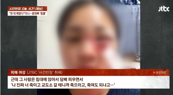 [서울=뉴시스] 폭행으로 인해 광대뼈가 함몰된 여성의 모습.(사진= '사건반장' 유튜브 캡처) 2025.05.09.*재판매 및 DB 금지