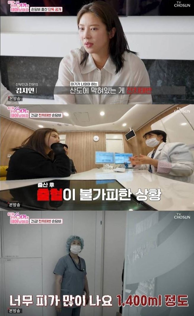 <b>손담비</b>, <b>출산</b>중 1400 출혈 "노산에 전치태반"