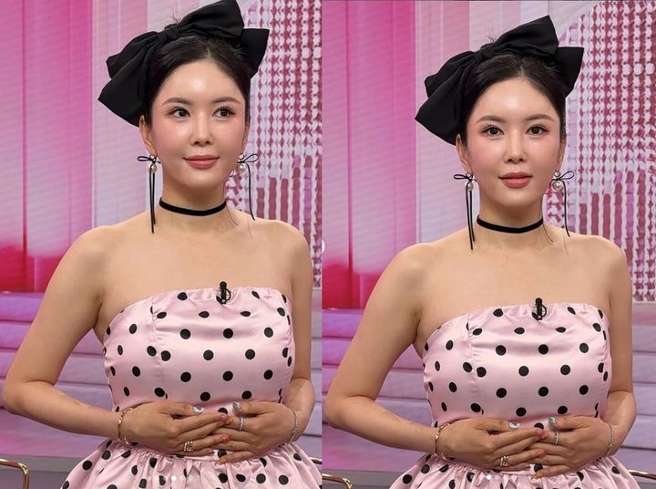 <b>장영란</b>, 4번째 눈<b>성형</b> 후 물오른 미모