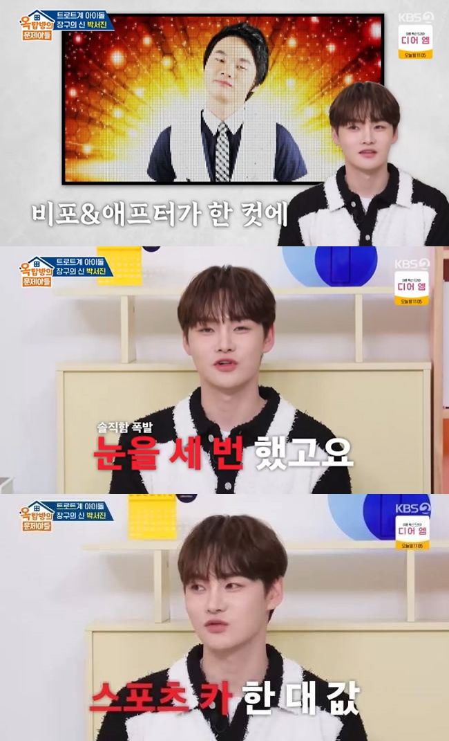 <b>박서진</b>, 억대 <b>성형</b>수술 "얼굴 전체 갈아끼워"