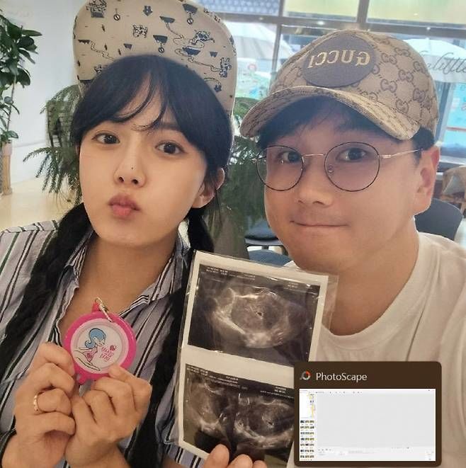 <b>강은비</b>, 불혹에 <b>자연임신</b> "3개월만 심봤다"