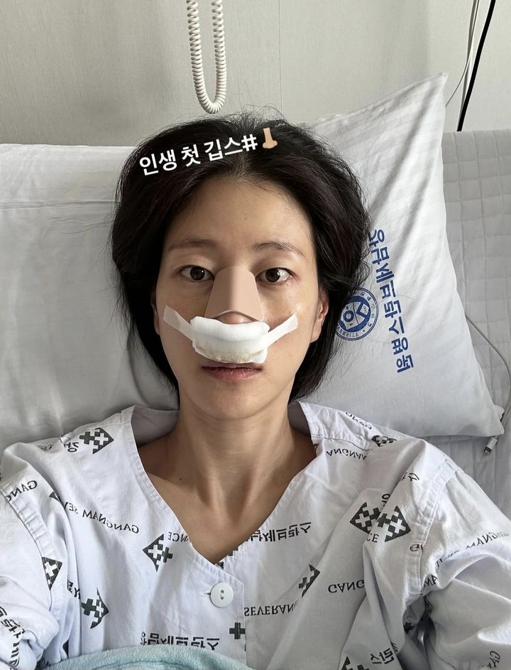 <b>이현이</b>, '골때녀' 경기 중 <b>코뼈 골절</b> "인생 첫 깁스"