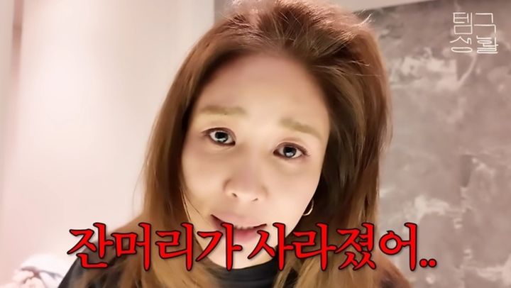 <b>옥주현</b>, <b>모발 이식 부작용</b> 고백 "잔머리 사라져 스트레스"