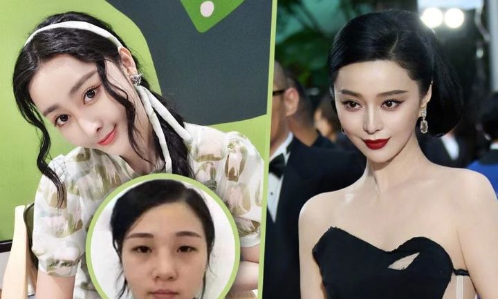 중국 본토 사회관계망서비스(SNS)에서 배우 판빙빙을 닮기 위해 약 800만 위안(약 16억 7000만원)을 성형수술에 쓴 여성의 최근 근황이 화제를 모으고 있다.2025.12.15.(사진=SCMP캡처) *재판매 및