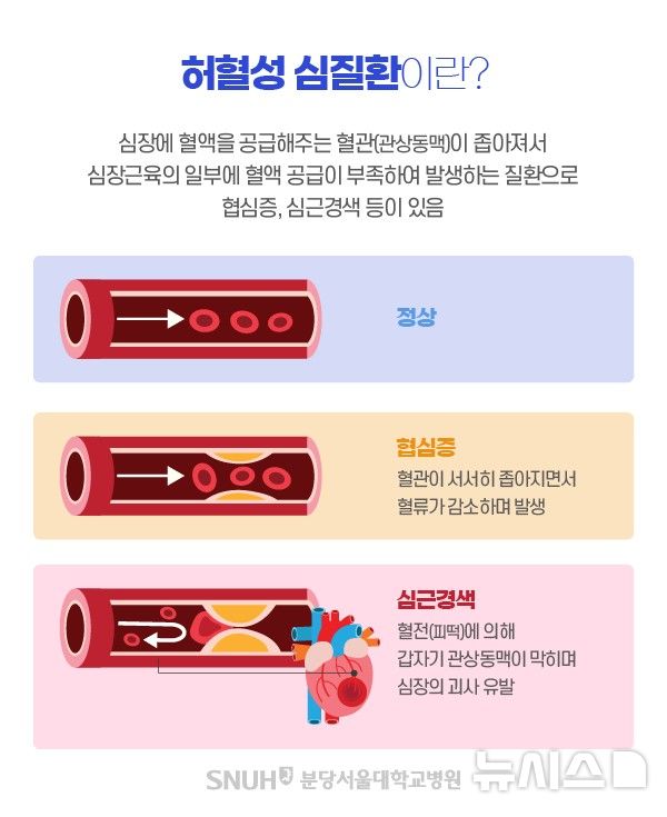 북극 한파에 심혈관 질환 비상! 1년 내 사망률 무려 26%