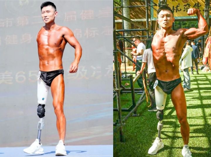 팔다리 잃고도 근육으로 승부한 대륙의 사나이, 감동 그 자체