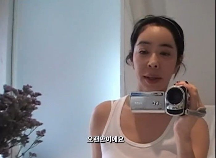 폐암 투병 <b>이혜영</b> "옆구리 절제…온몸이 흉터"