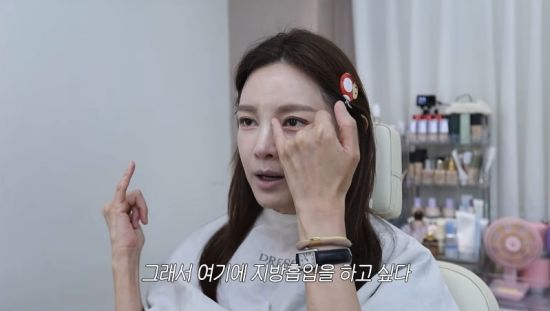 48세 정가은 "콧대 두꺼워 지방흡입 하고 파" 엉뚱 고백