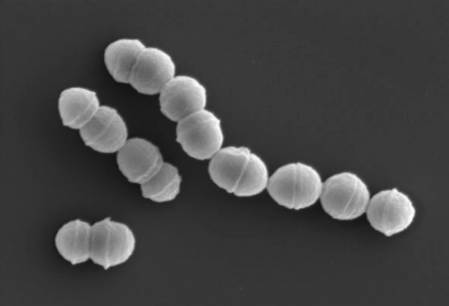 극증형 용혈성 연쇄상구균 감염증을 일으키는 균. 일본 국립 감염증 연구소 제공