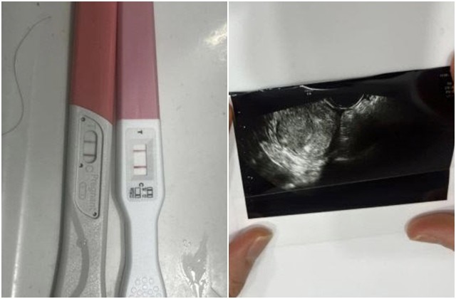 <b>프로야구 선수</b>도 ‘낙태 종용’ 논란…“널 망쳤다” 녹취도
