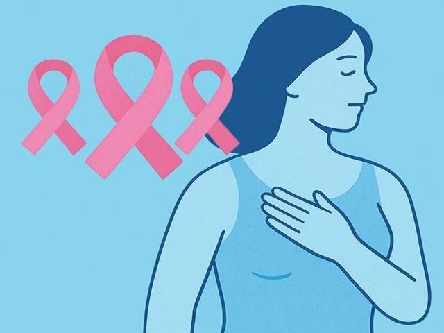 면역 항암제 효과 떨어진다면… 혈액검사 해보세요