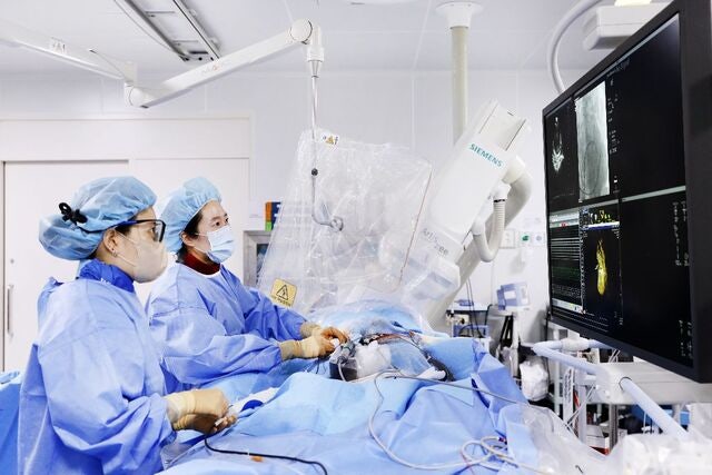 빠른 시술·손상 최소화… 돌연사 위험 심방세동 치료 새 선택지