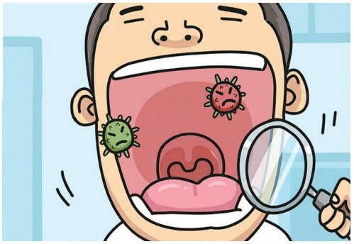 구강암 진단·치료, 환자 특성 반영한 정밀 의료 필요