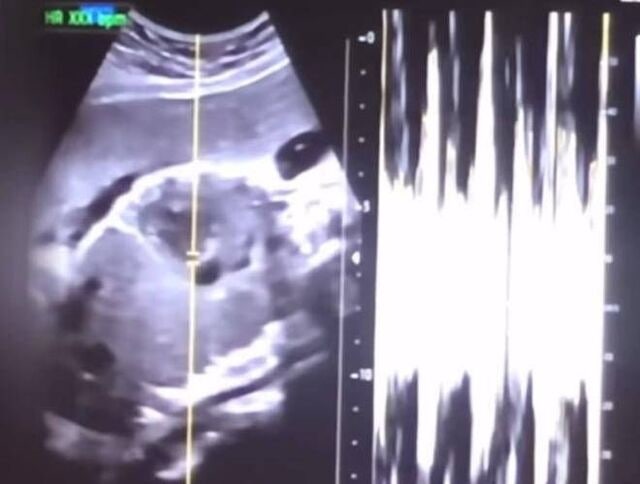 “36주 낙태, 병원장 살인 인정”… 산모는 “국가도 책임” 집유