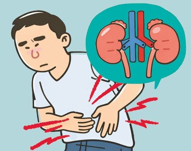 신장암 치료 ‘수술 후 보강요법’ 주목… 건보 적용 안돼 경제적 부담