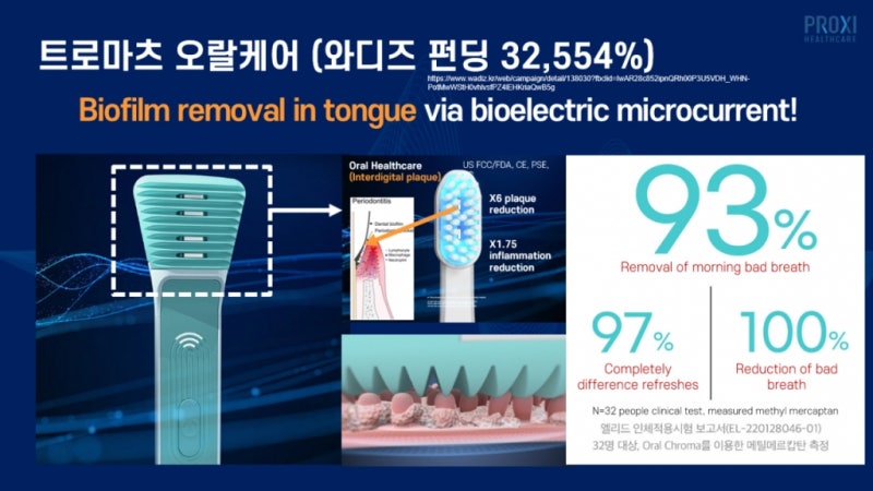 구취 없애려다 피 나거나 구역질...<b>혓바닥 백태</b> 제거 신기술 떴다