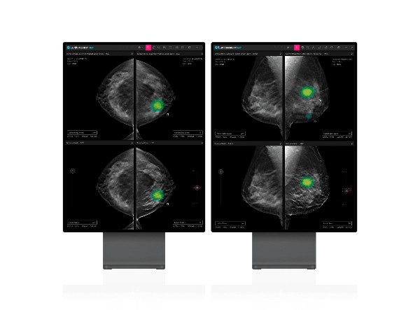 <b>루닛</b>, 3D 유방암 진단 AI 솔루션 '美 FDA' 승인 획득