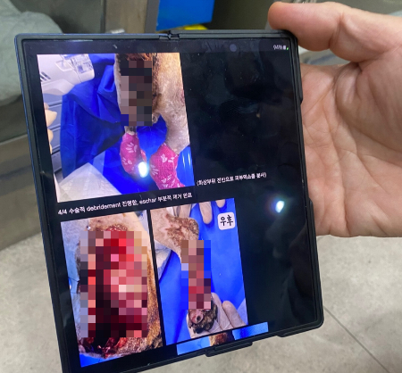 몽실이의 상태가 얼마나 심각했는지 보여주는 최중연 SNC동물메디컬센터 원장./사진=남형도 기자