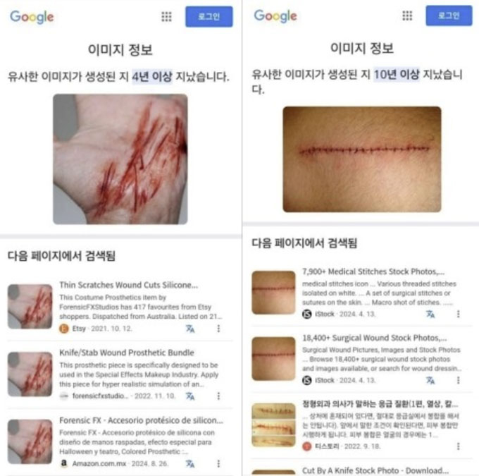  7일 배우 고(故) 김새론 유족 측 법률대리인과 유튜브 채널 '가로세로연구소' 김세의 대표는 김수현과 관련한 녹취 파일을 가진 제보자가 최근 피습당했다며 사진을 공개했다.이에 대해 김수현 측은 "인터넷에서 내려 