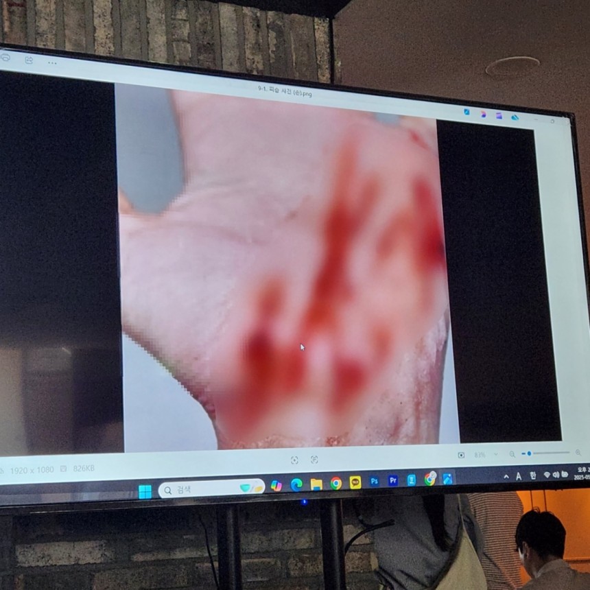 김세의 대표는 앞선 기자회견에서 A씨가 피습당한 사진이라며 자상을 입은 손과 어깨 사진을 공개했는데,<a href=