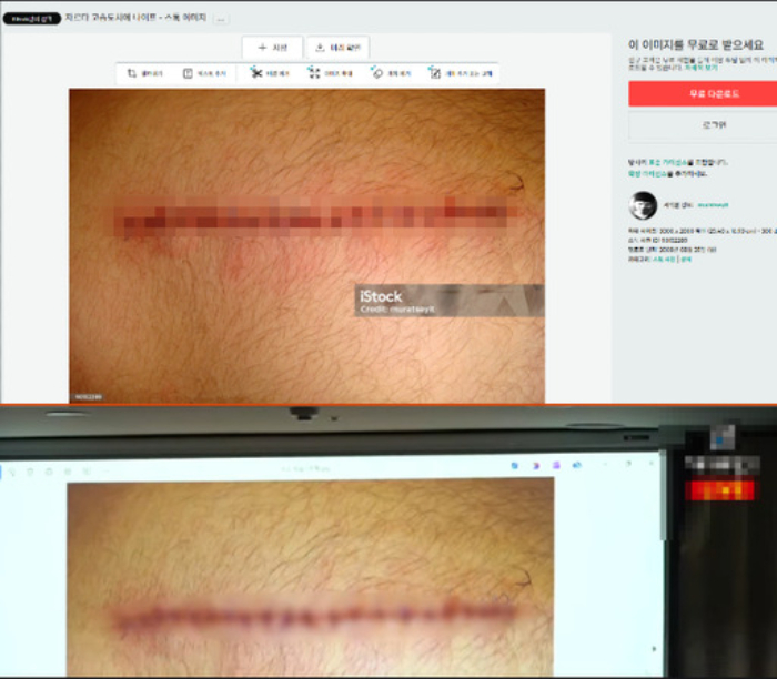 김세의 대표가 기자회견에서 공개한 A씨의 목,손 사진은 이미지 판매 사이트에서 도용한 것으로 확인됐다./사진=유튜브 채널 가로세로연구소,iStock 캡처