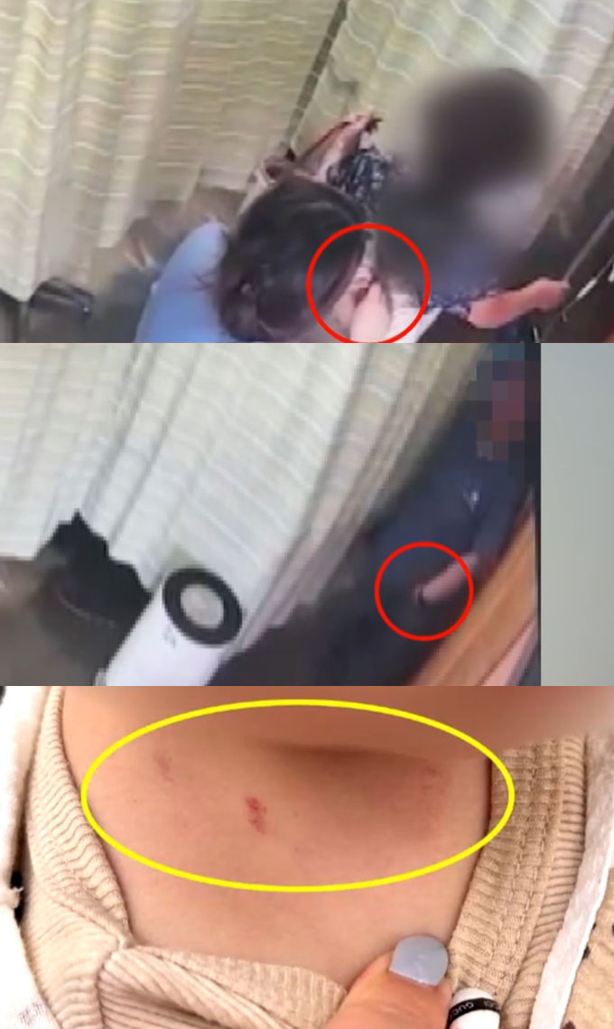 한 간호조무사가 고열로 수액을 맞으러 온 25개월 아이의 목에 걸린 금목걸이를 훔치는 CC(폐쇄회로)영상이 공개돼 비난이 쏟아졌다./사진=JTBC '사건반장' 방송 화면