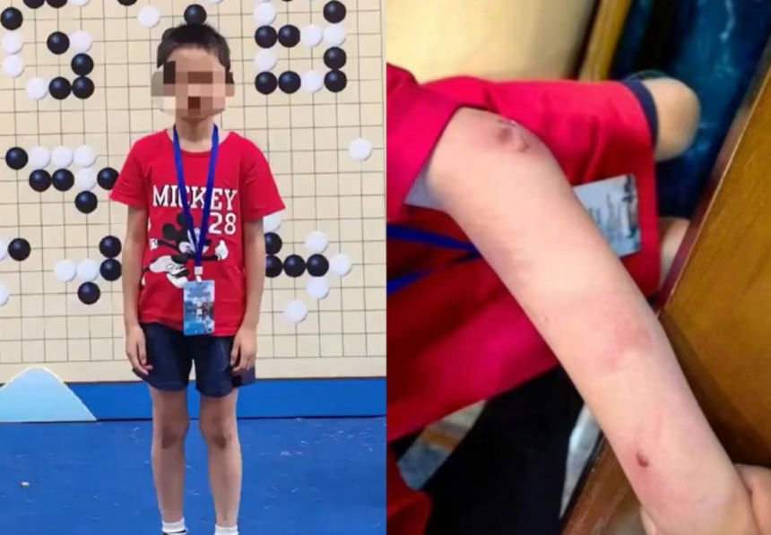 중국 바둑 신동 주훙신(9)이 아버지의 상습 학대에 못이겨 스스로 목숨을 끊었다는 의혹이 제기됐다. /사진=신화통신 갈무리