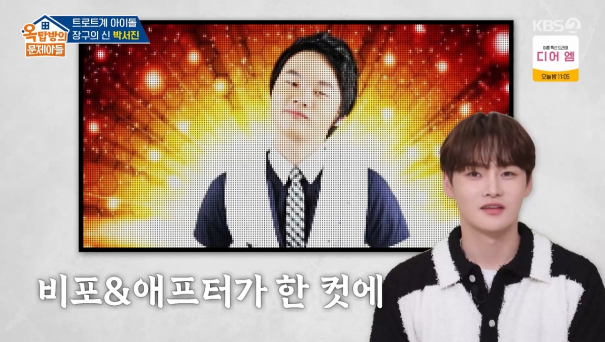 <b>박서진</b> "<b>성형</b>에만 스포츠카 한 댓값…눈만 3번→모발 이식도"