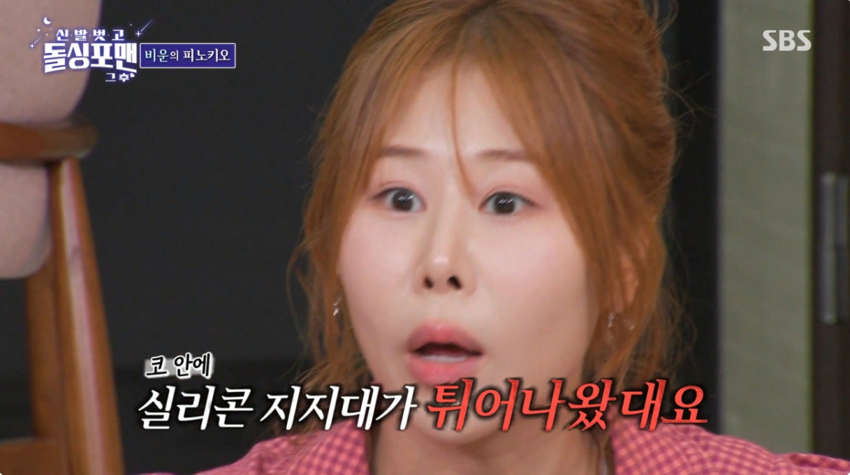 <b>박세미</b>, 극단 시절 개그 하다 코에 <b>실리콘</b> 빠져 "지금보다 더 높았는데...
