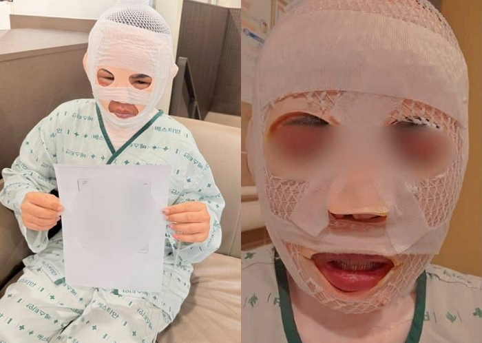 한국 남친이 태국 여친 얼굴에 끓는 물 붓는 충격적인 사건 발생