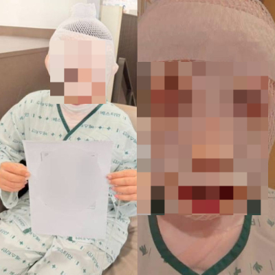 태국인 아내 얼굴에 끓는 물을 부어 심각한 화상을 입힌 40대 남성이 경찰에 붙잡혔다./사진=페이스북 갈무리 