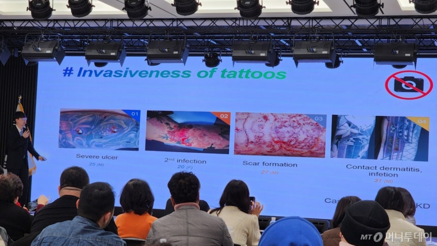 피부과 전문의인 김재홍 대한피부과의사회 기획정책이사(의협 '비의료인의 문신시술 법제화 대응' TF 위원)가 문신시술 후 피부 궤양,감염,흉터 형성,<a href=
