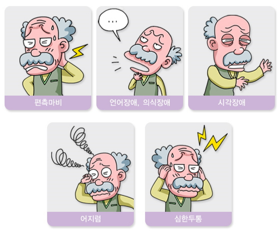 가벼운 뇌졸중일 때 찾아오는 증상.이런 증상이 잠깐 나타났다가 사라졌더라도 뇌졸중을 의심해 빨리 내원해야 한다./자료=국가건강정보포털 