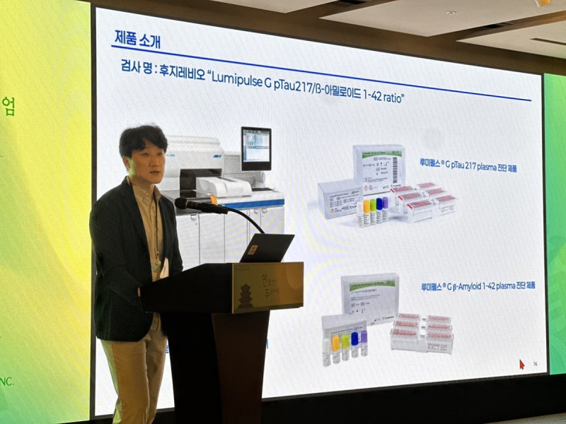 대웅바이오, 랩지노믹스와 혈액 기반 알츠하이머병 진단 기술 도입