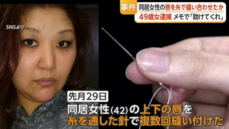 바늘과 실로 동거녀 입술 꿰매…40대 일본 여성, 엽기 잔혹 범죄