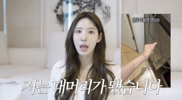 <b>이나연</b>, 모발이식 부작용으로 탈모…"1cm 채우려다 30cm 날아가"