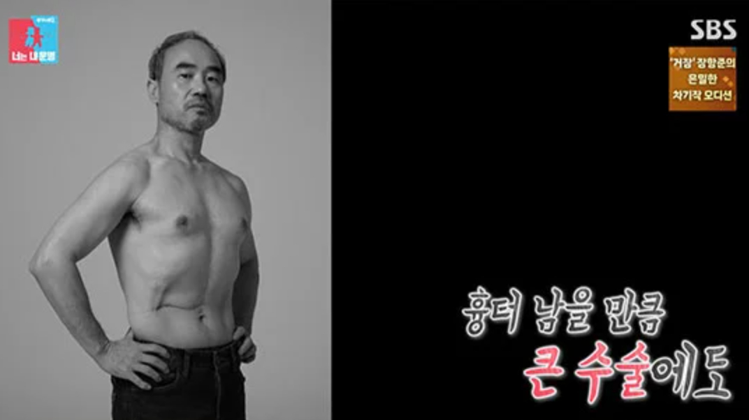 '황금신부' <b>강신일</b>, <b>간암</b> 수술 2주 만에 촬영한 사연..."빚 갚아야"