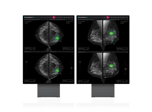 ‘<b>루닛</b>’ 유방암 진단 AI 솔루션, 美 FDA 승인받았다