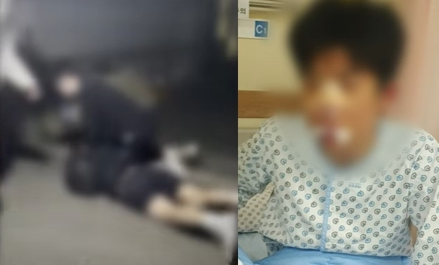  고등학교 3학년 남학생이 또래 남학생들에게 집단 폭행을 당하는 일이 벌어졌다.피해 학생은 코뼈가 부러지는 등 전치 3주 진단을 받았다.[사진 출처 = 부산MBC 캡처]