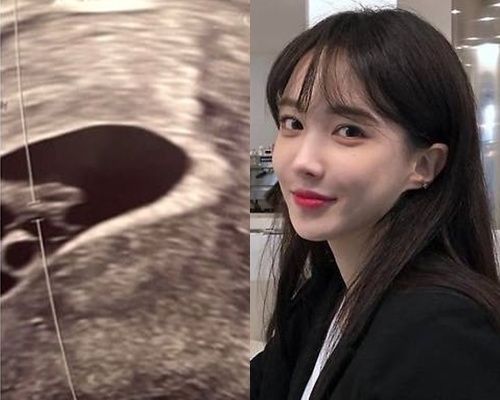  서민재.사진 I 서민재 인스타그램