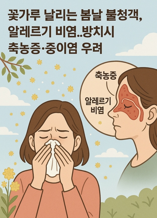 꽃가루,축농증,알레르기,비염 등의 키워드로 챗GPT가 생성한 이미지