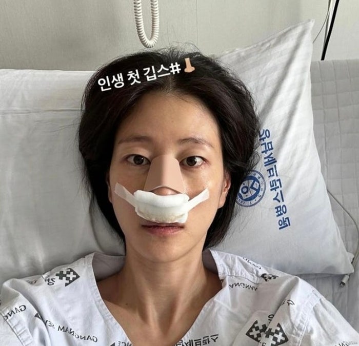 “SBS에서 산재 처리해줘”…‘프로 선수급’ <b>이현이</b>, 결국 <b>코뼈 골절</b>